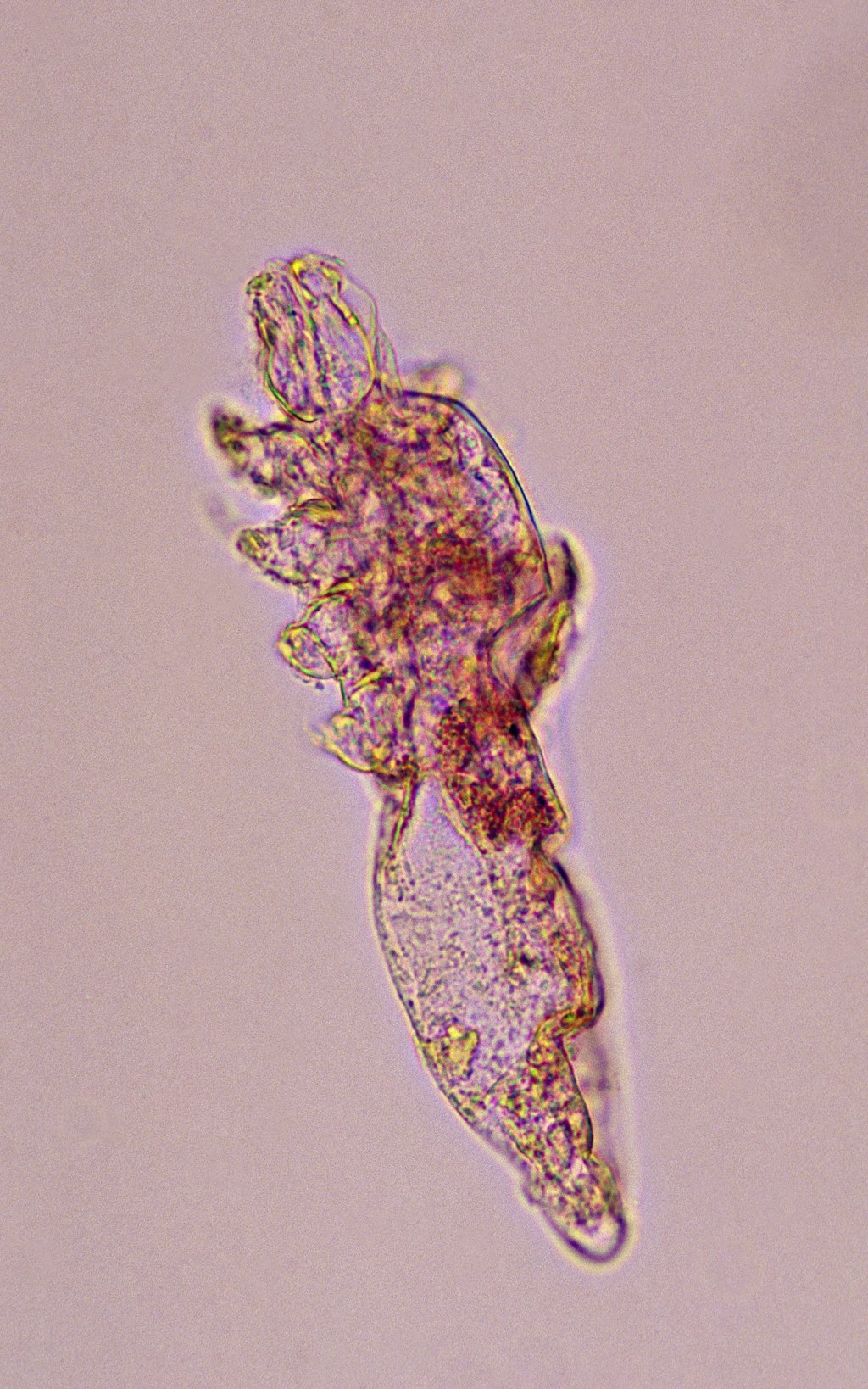 These mites are helping your skin. Credit: Ed Reschke / Getty