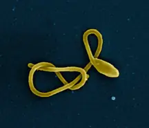 Ebola is among the world