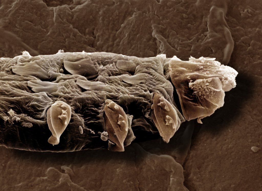 These tiny mites could be on your face right now. Credit: David Spears FRPS FRMS / Getty