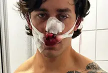 John Rudat suffered extensive facial injuries after the attack. Credit: GoFundMe